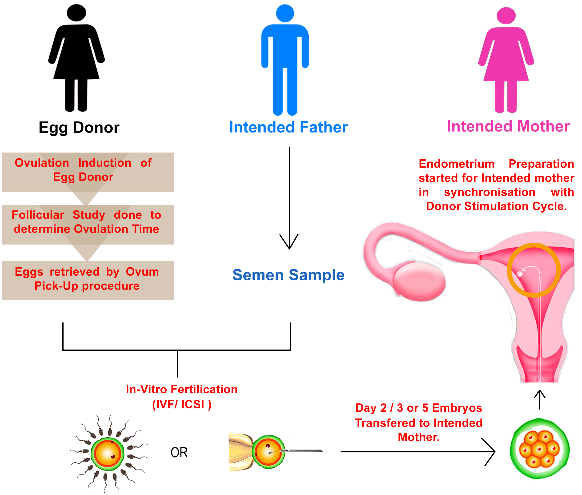 using donor eggs