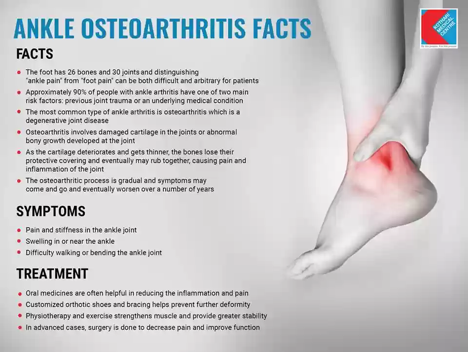 Ankle osteoarthritis facts