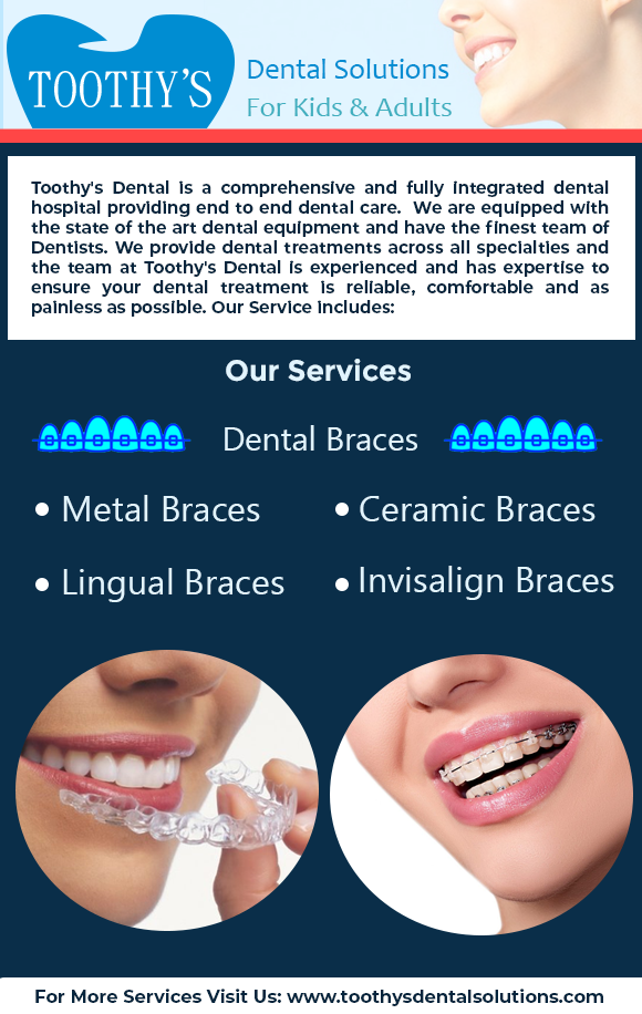 Best dental clinic in hyderabaed